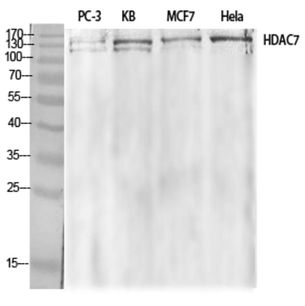 Western Blot - Anti-HDAC7A Antibody (B8511) - Antibodies.com