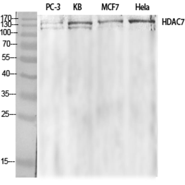 Western Blot - Anti-HDAC7A Antibody (B8511) - Antibodies.com