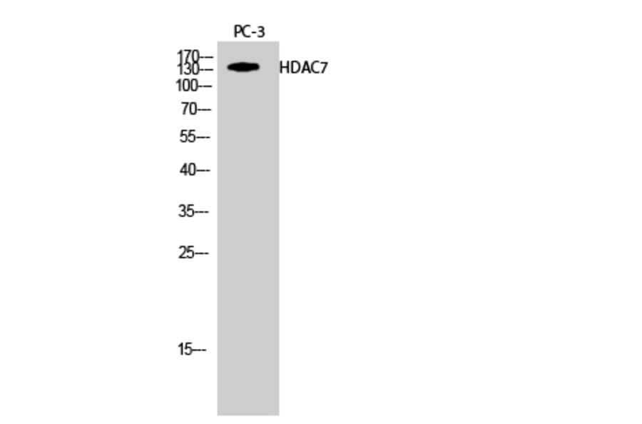 Western Blot - Anti-HDAC7A Antibody (B8511) - Antibodies.com