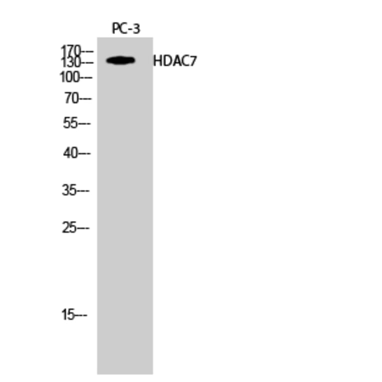 Western Blot - Anti-HDAC7A Antibody (B8511) - Antibodies.com