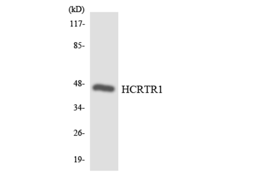 Western Blot - Anti-HCRTR1 Antibody (R12-2868) - Antibodies.com
