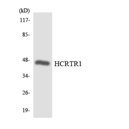 Western Blot - Anti-HCRTR1 Antibody (R12-2868) - Antibodies.com