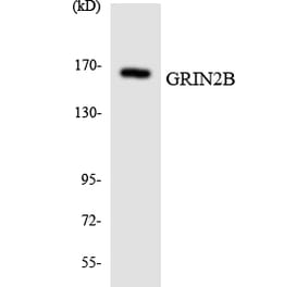 Western Blot - Anti-GRIN2B Antibody (R12-2856) - Antibodies.com