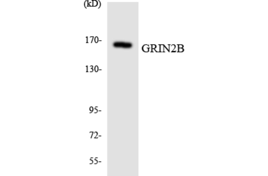 Western Blot - Anti-GRIN2B Antibody (R12-2856) - Antibodies.com
