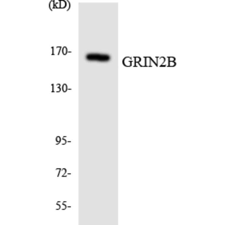 Western Blot - Anti-GRIN2B Antibody (R12-2856) - Antibodies.com