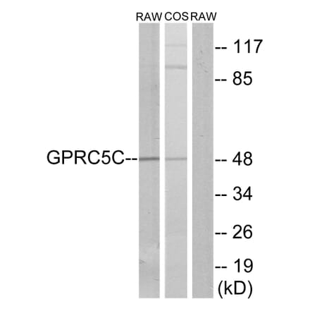 Western Blot - Anti-GPRC5C Antibody (G319) - Antibodies.com