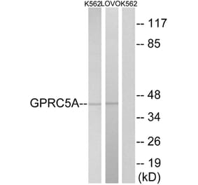 Western Blot - Anti-GPRC5A Antibody (G735) - Antibodies.com