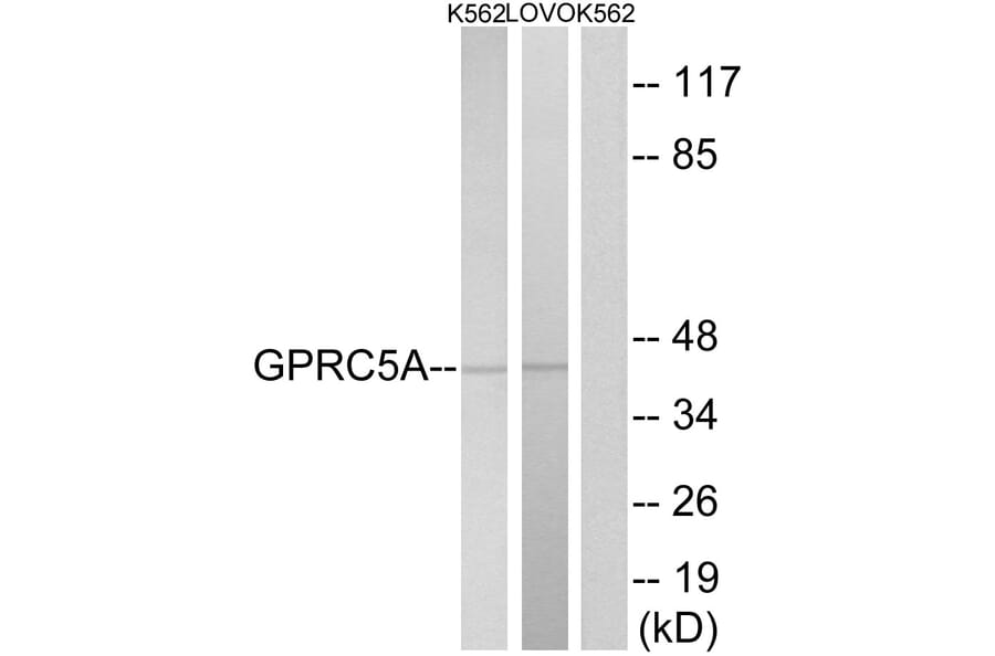 Western Blot - Anti-GPRC5A Antibody (G735) - Antibodies.com