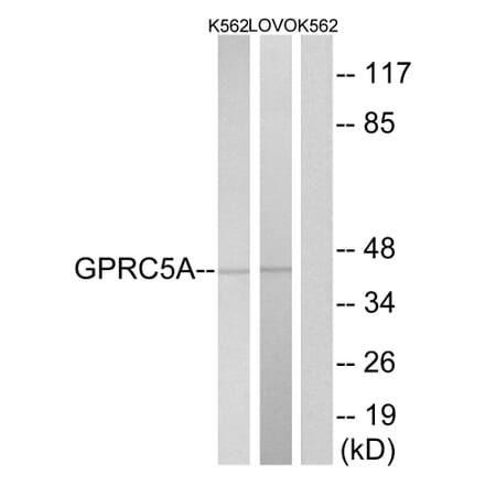 Western Blot - Anti-GPRC5A Antibody (G735) - Antibodies.com