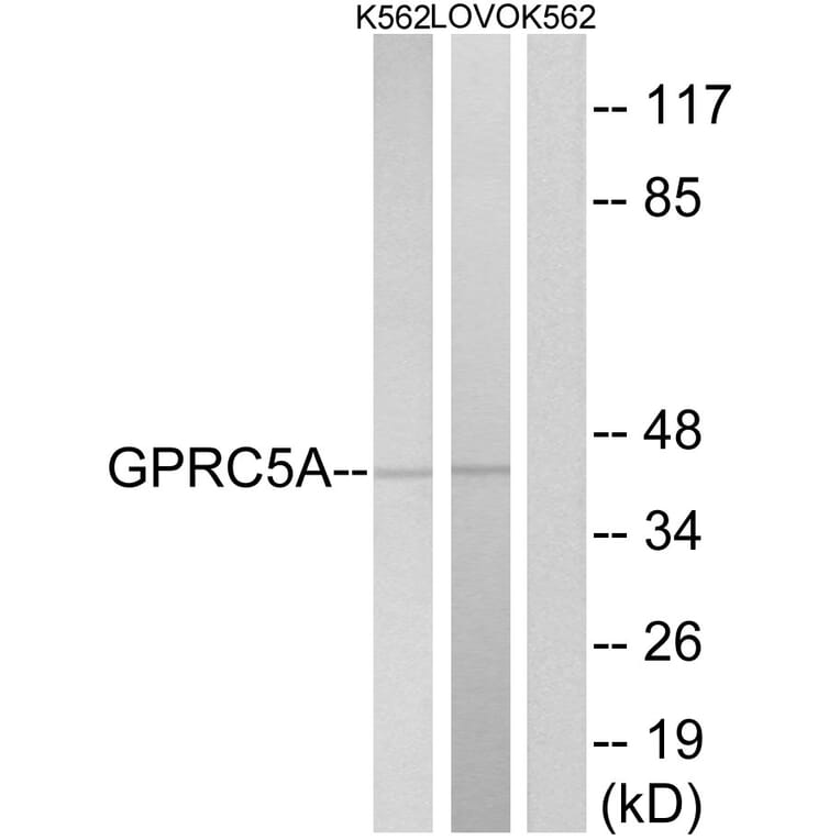 Western Blot - Anti-GPRC5A Antibody (G735) - Antibodies.com