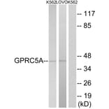 Western Blot - Anti-GPRC5A Antibody (G735) - Antibodies.com