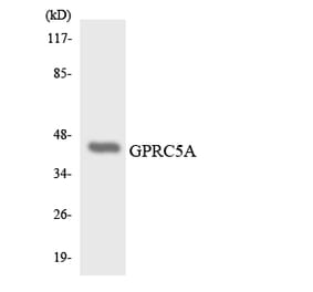 Western Blot - Anti-GPRC5A Antibody (R12-2849) - Antibodies.com