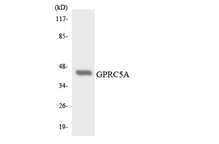 Western Blot - Anti-GPRC5A Antibody (R12-2849) - Antibodies.com