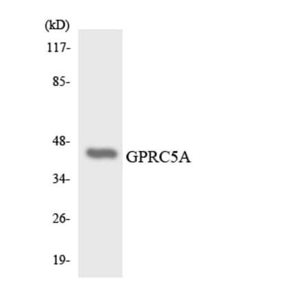 Western Blot - Anti-GPRC5A Antibody (R12-2849) - Antibodies.com