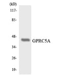 Western Blot - Anti-GPRC5A Antibody (R12-2849) - Antibodies.com
