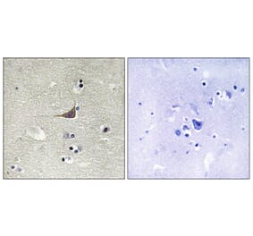 Immunohistochemistry - Anti-GPR180 Antibody (G316) - Antibodies.com