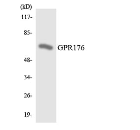 Western Blot - Anti-GPR176 Antibody (R12-2841) - Antibodies.com