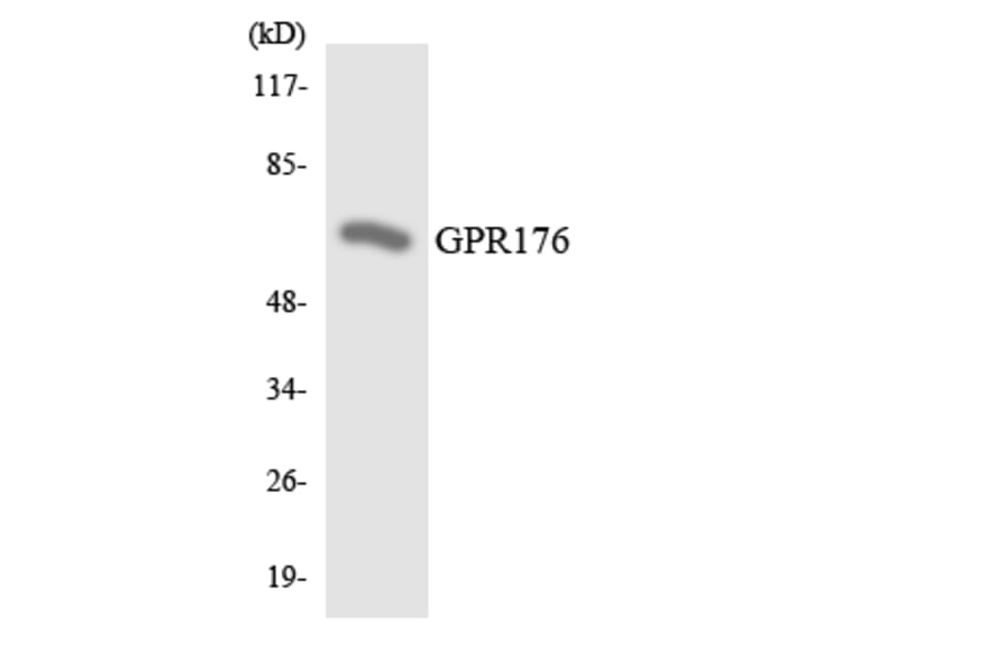 Western Blot - Anti-GPR176 Antibody (R12-2841) - Antibodies.com