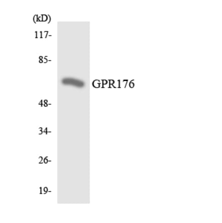 Western Blot - Anti-GPR176 Antibody (R12-2841) - Antibodies.com