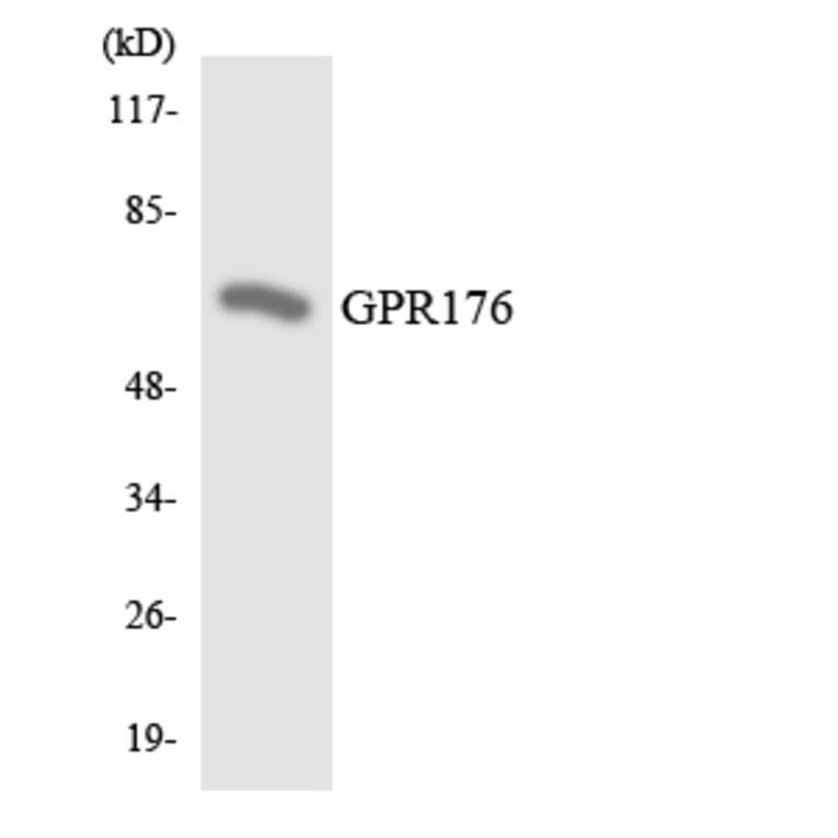 Western Blot - Anti-GPR176 Antibody (R12-2841) - Antibodies.com