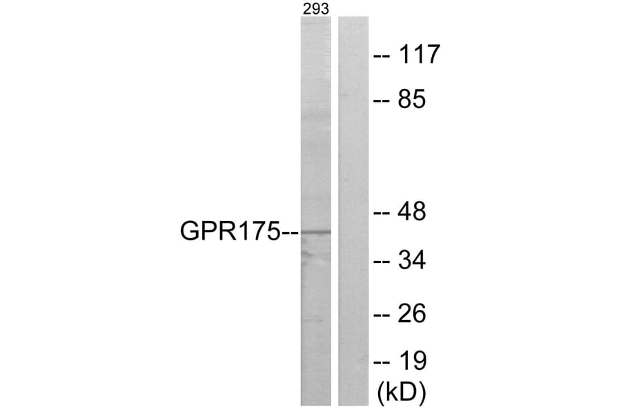 Western Blot - Anti-GPR175 Antibody (G146) - Antibodies.com