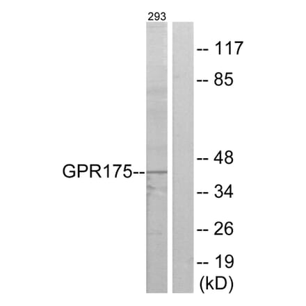 Western Blot - Anti-GPR175 Antibody (G146) - Antibodies.com