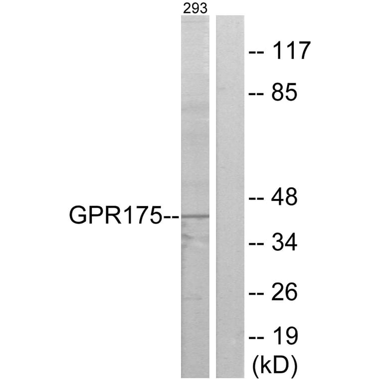 Western Blot - Anti-GPR175 Antibody (G146) - Antibodies.com