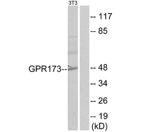Western Blot - Anti-GPR173 Antibody (G144) - Antibodies.com