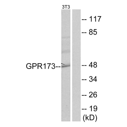 Western Blot - Anti-GPR173 Antibody (G144) - Antibodies.com
