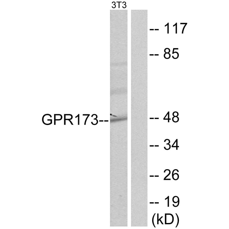 Western Blot - Anti-GPR173 Antibody (G144) - Antibodies.com