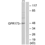 Western Blot - Anti-GPR173 Antibody (G144) - Antibodies.com
