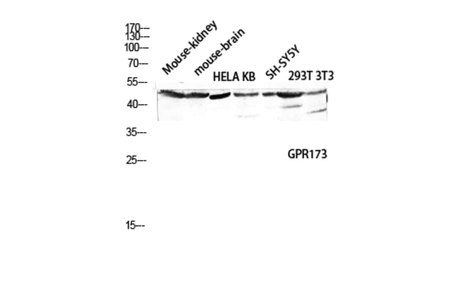 Western Blot - Anti-GPR173 Antibody (G144) - Antibodies.com