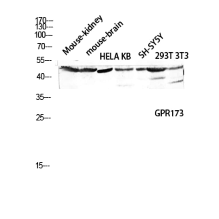 Western Blot - Anti-GPR173 Antibody (G144) - Antibodies.com
