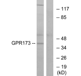 Western Blot - Anti-GPR173 Antibody (G311) - Antibodies.com