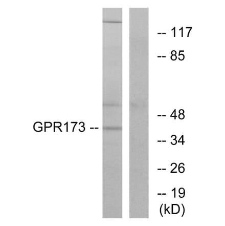 Western Blot - Anti-GPR173 Antibody (G311) - Antibodies.com