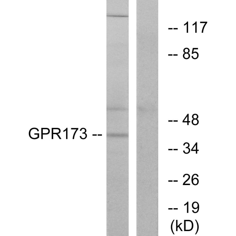 Western Blot - Anti-GPR173 Antibody (G311) - Antibodies.com