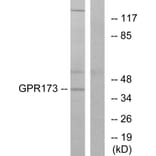 Western Blot - Anti-GPR173 Antibody (G311) - Antibodies.com