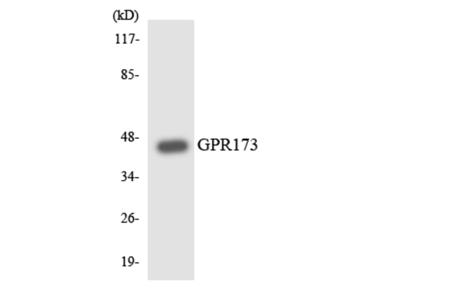 Western Blot - Anti-GPR173 Antibody (R12-2838) - Antibodies.com