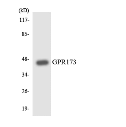 Western Blot - Anti-GPR173 Antibody (R12-2838) - Antibodies.com