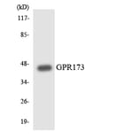 Western Blot - Anti-GPR173 Antibody (R12-2838) - Antibodies.com