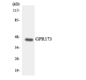 Western Blot - Anti-GPR173 Antibody (R12-2839) - Antibodies.com