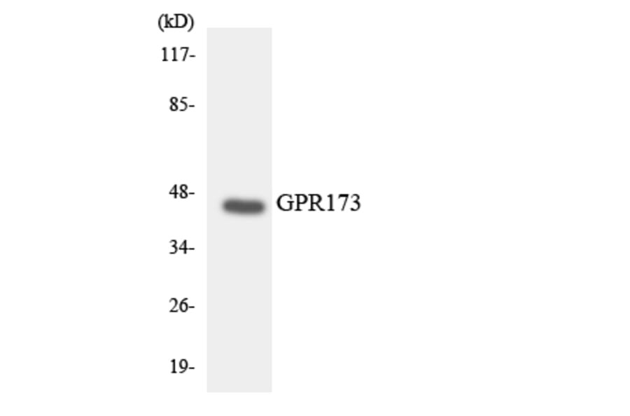 Western Blot - Anti-GPR173 Antibody (R12-2839) - Antibodies.com