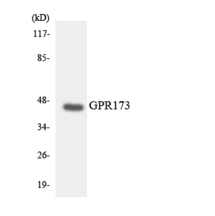 Western Blot - Anti-GPR173 Antibody (R12-2839) - Antibodies.com
