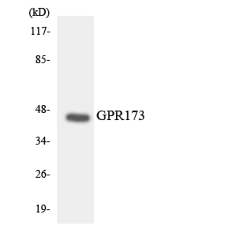 Western Blot - Anti-GPR173 Antibody (R12-2839) - Antibodies.com