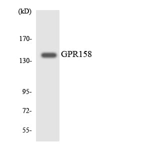 Western blot analysis of the lysates from HeLa cells using Anti-GPR158 Antibody.