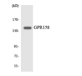 Western Blot - Anti-GPR158 Antibody (R12-2836) - Antibodies.com