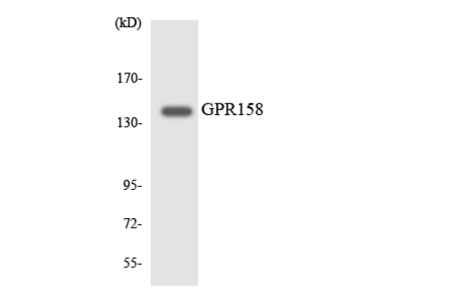 Western Blot - Anti-GPR158 Antibody (R12-2836) - Antibodies.com