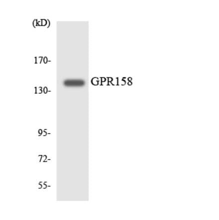 Western Blot - Anti-GPR158 Antibody (R12-2836) - Antibodies.com