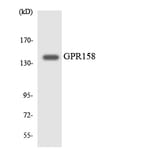 Western Blot - Anti-GPR158 Antibody (R12-2836) - Antibodies.com