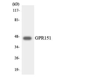 Western Blot - Anti-GPR151 Antibody (R12-2833) - Antibodies.com